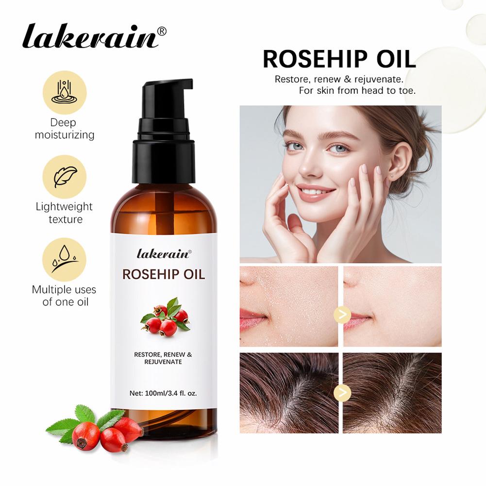 Cold Pressed Rose Hip - Minyak Rosehip Untuk Wajah & Kulit