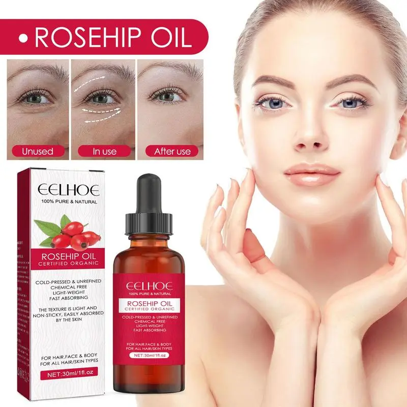 Cold Pressed Rose Hip - Minyak biji Rosehip organik 30ml, untuk